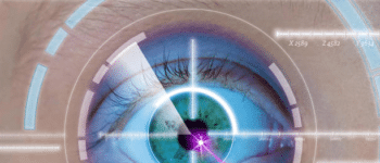 Eye surgery graphic
