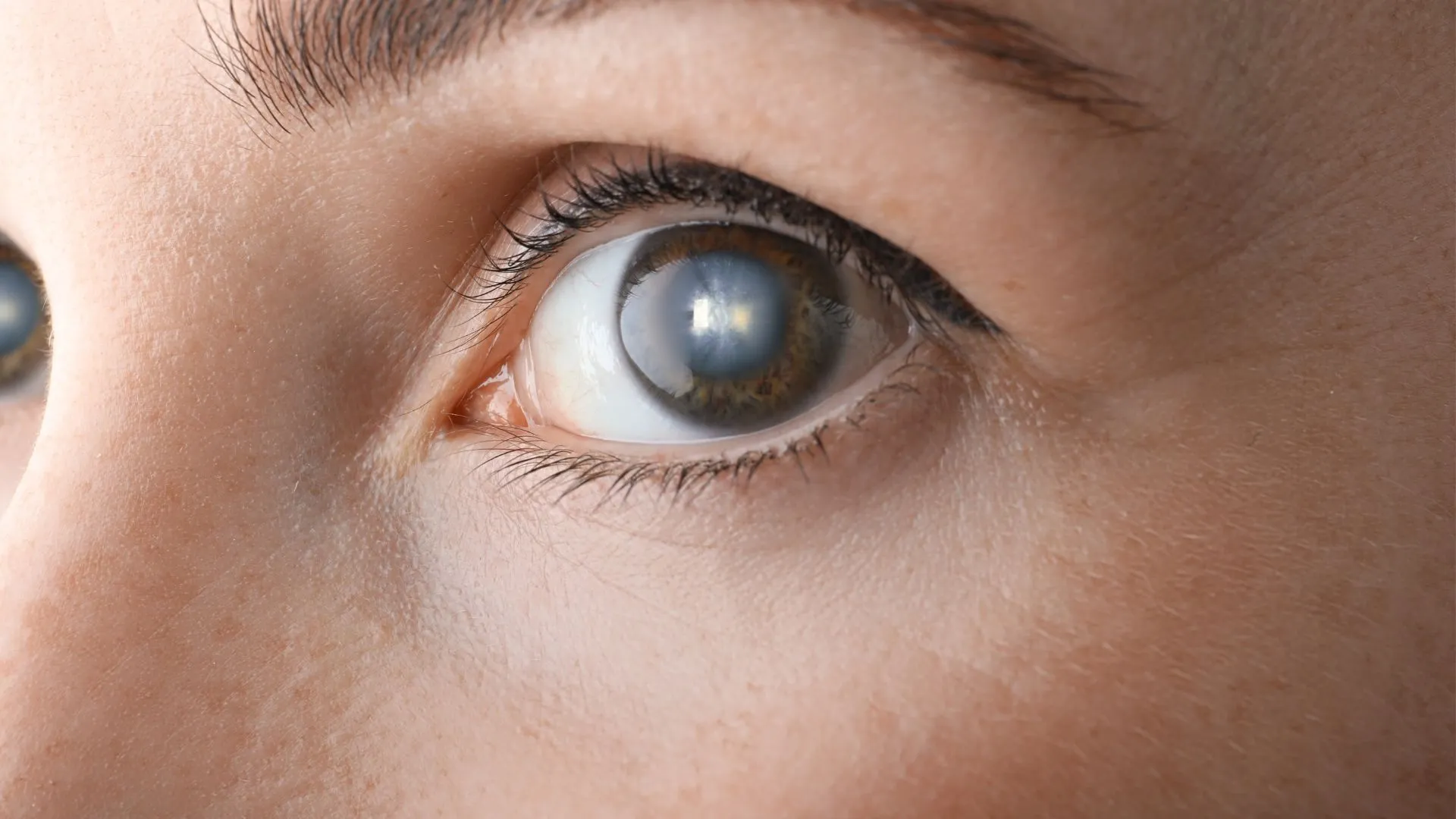 Warning Signs of Cataracts You Should Never Ignore