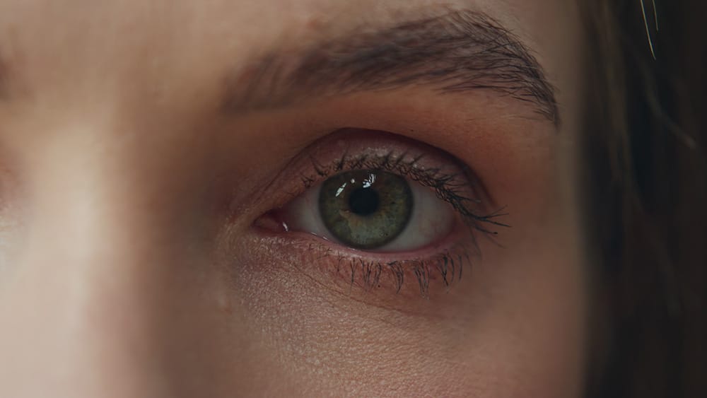 What If You Blink During LASIK