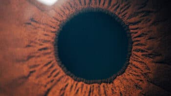 EVO ICL for Thin Corneas