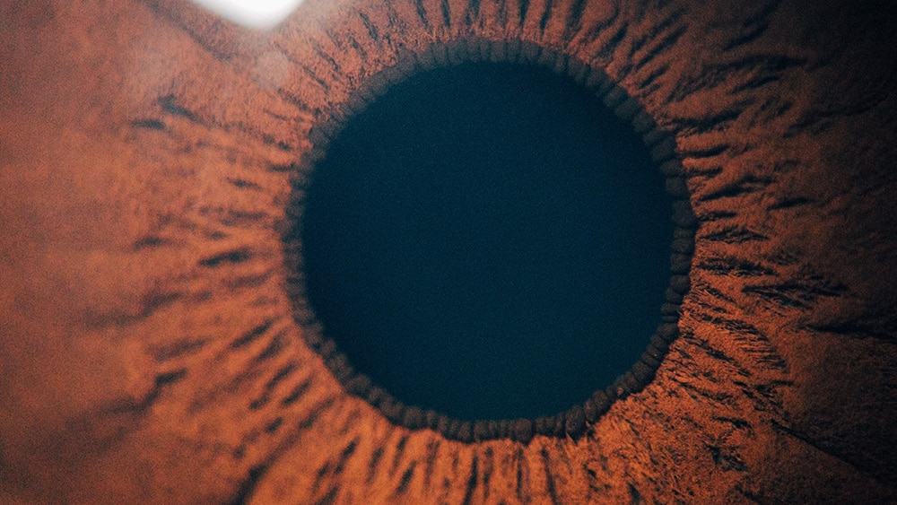 EVO ICL for Thin Corneas