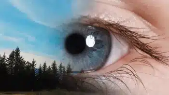 RLE vs. LASIK Eye Surgery